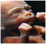 Week 26 Fetal Development